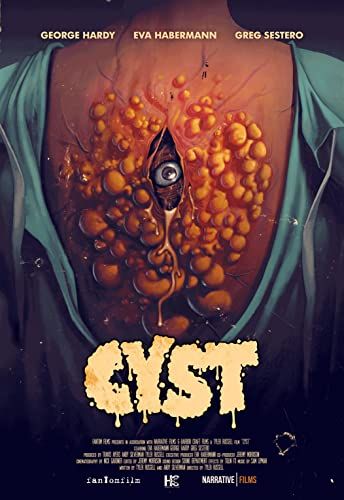 Cyst online film