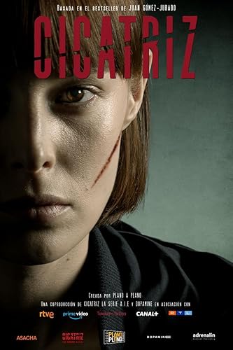 A sebhelyes lány - 1. évad online film